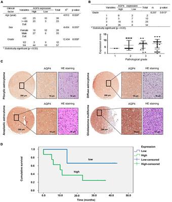 Identification of the prognostic and immunological roles of aquaporin 4: A potential target for survival and immunotherapy in glioma patients